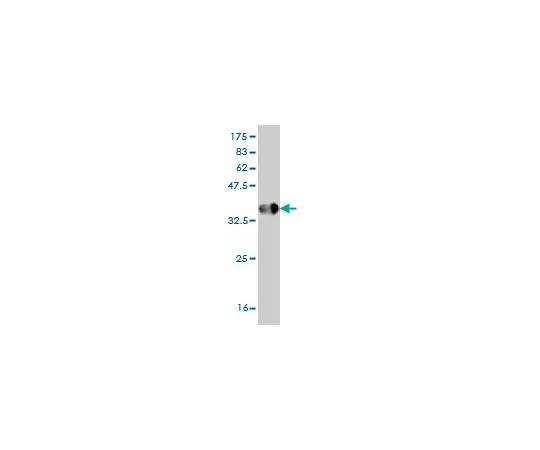 62-8533-84　Anti-HPSE Mo*** mAb (4D7)　ST1611-100UG