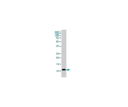62-8478-82　Anti-S100A7 Mo*** mAb (1A4)　CB1036-100UG