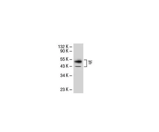 62-8440-96　Anti-Tissue Factor Mo*** mAb (TF9-10H10)　612161-500UG