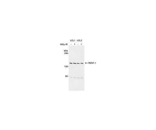 62-8481-27　Anti-RENT1 Goat pAb　DR1015-100UG