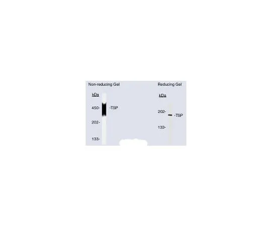 62-8478-43　Anti-Thrombospondin (Ab-3) Mo*** mAb (A6.1)　BA24-100UG