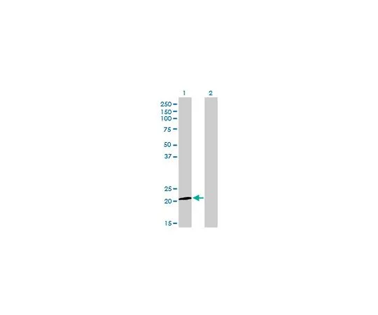 62-8481-43　Anti-ATF3 Mo*** mAb (6B8)　DR1086-100UG