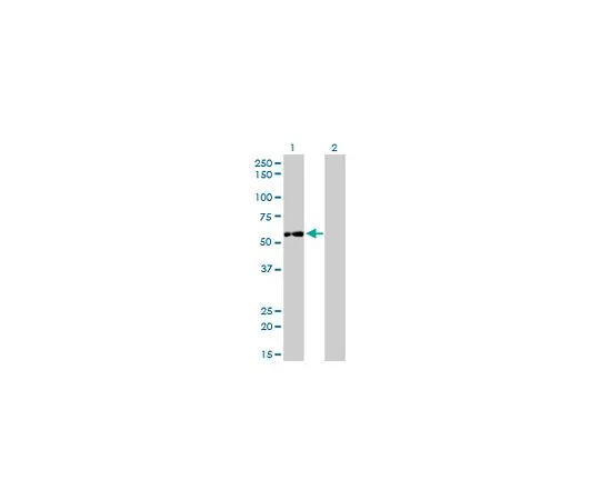 62-8533-73　Anti-IMPDH2 Mo*** mAb (1E12-B6)　ST1578-100UG