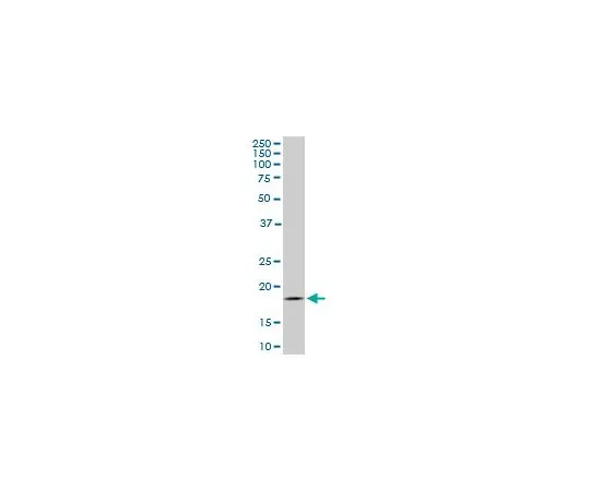 62-8534-16　Anti-TOMM22 Mo*** mAb (4G4)　ST1704-100UG