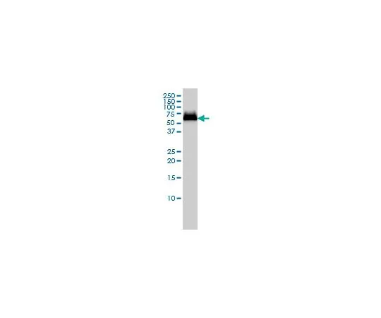 62-8477-57　Anti-GBA Mo*** mAb (2E2)　AP1140-100UG