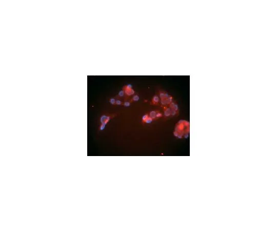 62-8488-19　Anti-LDL Receptor Mo*** mAb (15C8)　LP02-100UG