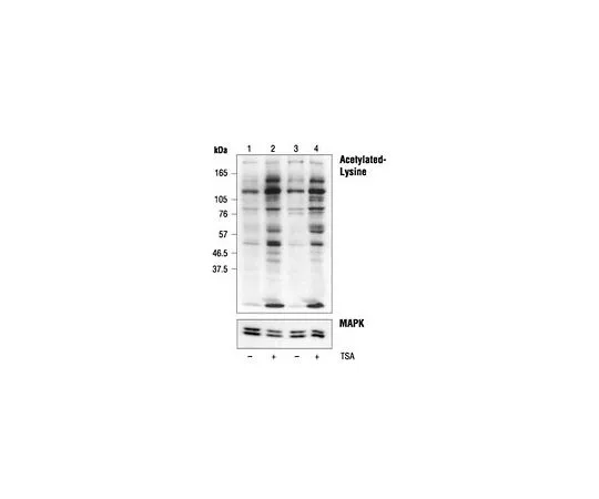 62-8533-34　Anti-Acetylated Lysine Rabbit pAb　ST1027-50UL