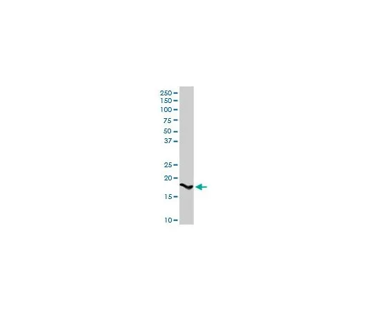 62-8477-58　Anti-SPINK1 Rabbit pAb　AP1142-100UG