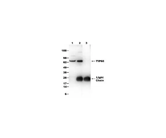 62-8481-31　Anti-TIP60 Rabbit pAb　DR1041-50UL
