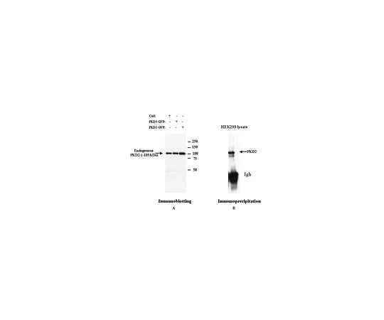 62-8533-38　Anti-PKD2 Rabbit pAb　ST1042-50UG