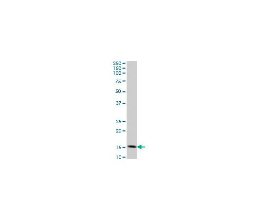 62-8534-17　Anti-TOMM20 Mo*** mAb (4F3)　ST1705-100UG