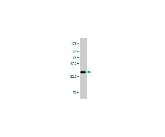 62-8477-56　Anti-ARSB Mo*** mAb (1A4)　AP1139-100UG