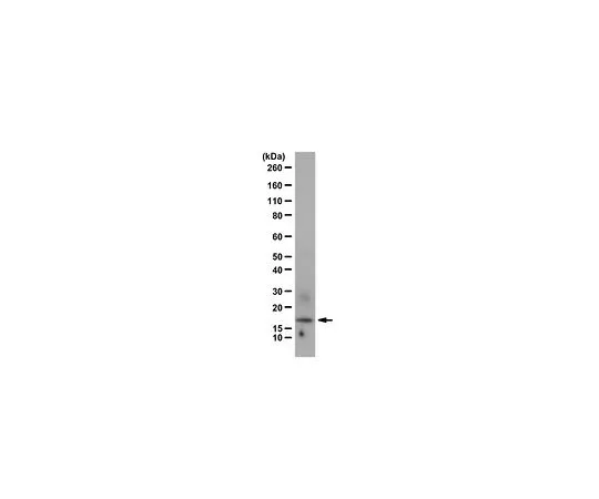 62-8383-91　［Discontinued］Anti-FHIT　07-172-I