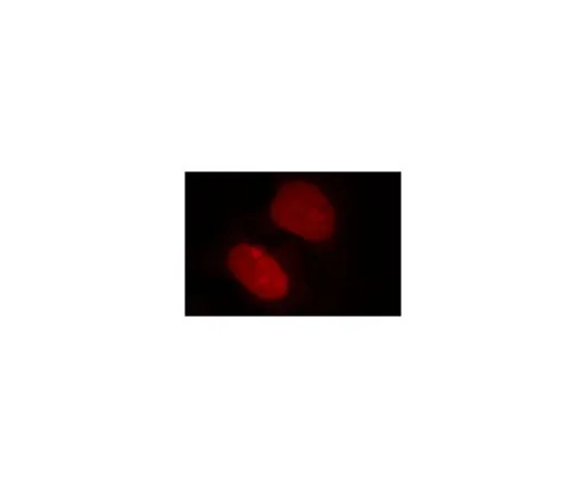 62-8520-12　［Discontinued］Anti-HDGF, clone 60064-1　MABN1096