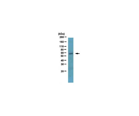 62-8460-53　［Discontinued］Anti-LSF; 100 μg　ABE180