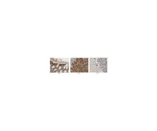 62-8466-98　［Discontinued］Anti-MPRIP Antibody ABN408　ABN408
