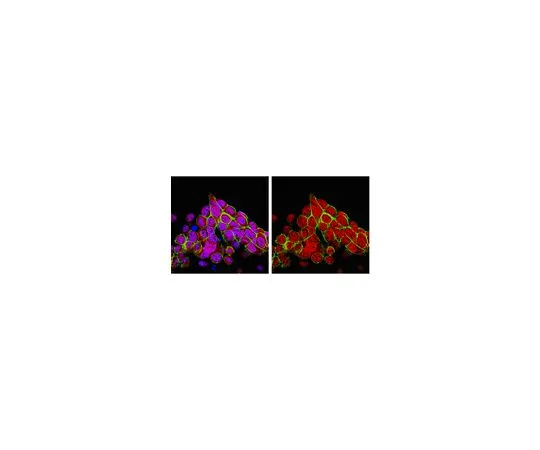 62-8389-93　［Discontinued］Anti-JMJD2A; 100 μg　09-809