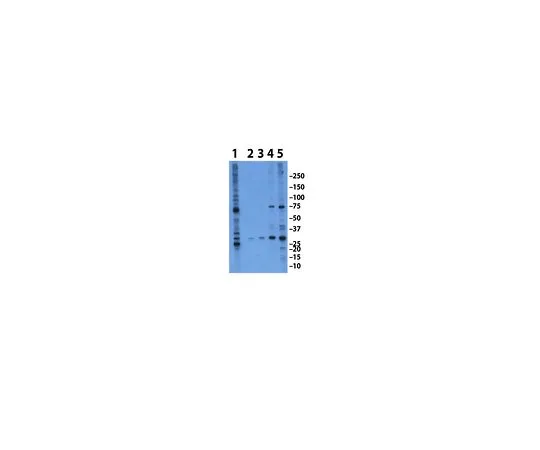 62-8452-79　［Discontinued］Anti-APH-1; 100 μL　AB9214