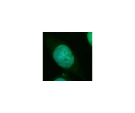 62-8465-01　［Discontinued］Anti-TSPYL2　ABF258