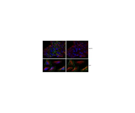 62-8516-83　［Discontinued］Anti-S100A7, clone 14F6.1　MABN123