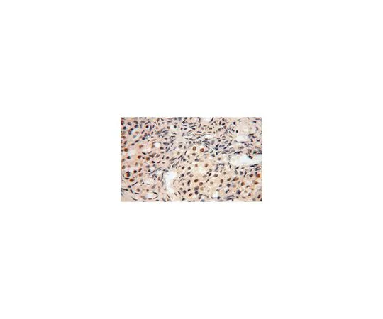 62-8462-57　［Discontinued］Anti-POLR1C　ABE632