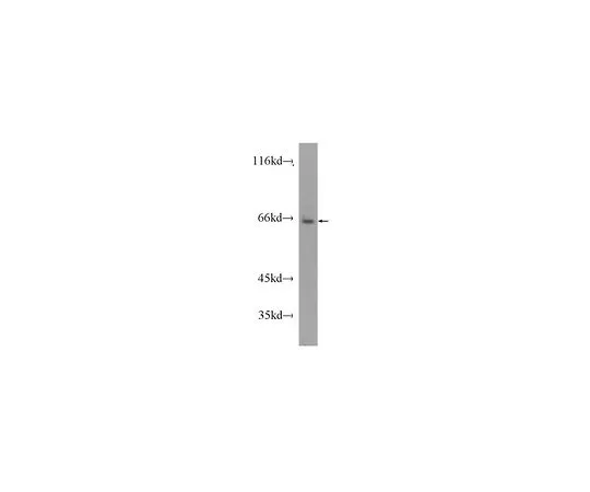 62-8470-82　［Discontinued］Anti-SLC11A2　ABS581