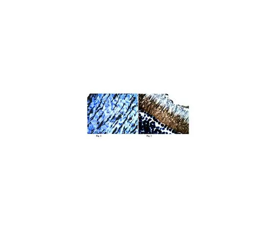 62-8452-47　［Discontinued］Anti-Fibulin-6; 100 μg　AB6066