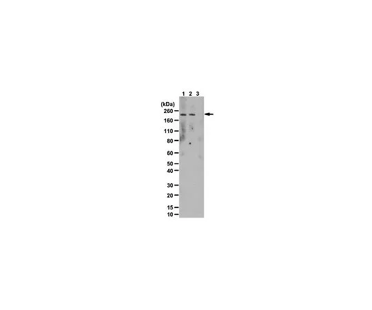 62-8469-41　［Discontinued］Anti-phospho-LRRK2 (Tyr1491); 100 μg　ABS108