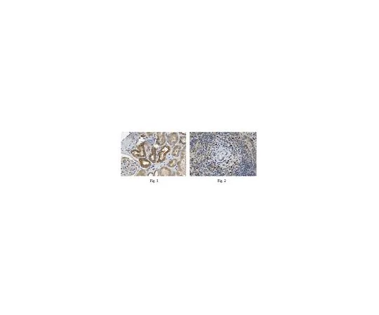 62-8457-64　［Discontinued］Anti-SCARB1　ABC326