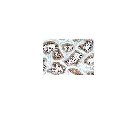 62-8458-03　［Discontinued］Anti-HSPA2　ABC409