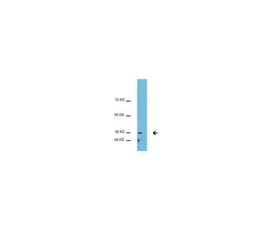 62-8389-16　［Discontinued］Anti-acetyl C/EBPβ (Lys215, Lys216); 100 μg　09-037