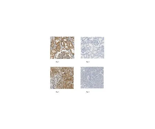 62-8469-82　［Discontinued］Anti-VEGF165　ABS282