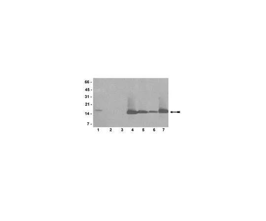 62-8368-68　［Discontinued］Anti-dimethyl Histone H3 (Arg2) Trial Size　04-808-S