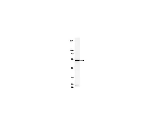 62-8382-03　［Discontinued］Anti-DR4/TRAIL-R1; 200 μg　06-744