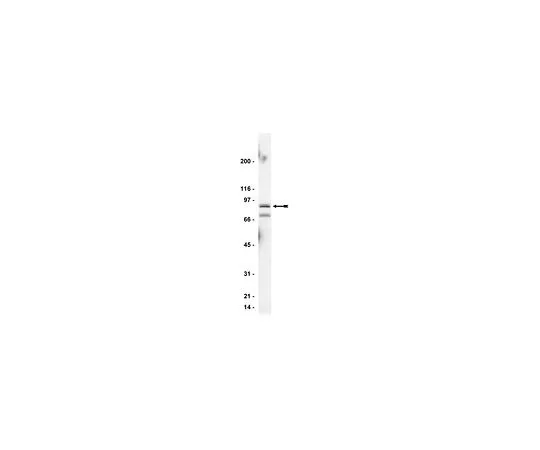 62-8381-82　［Discontinued］Anti-StIP-1; 200 μg　06-650