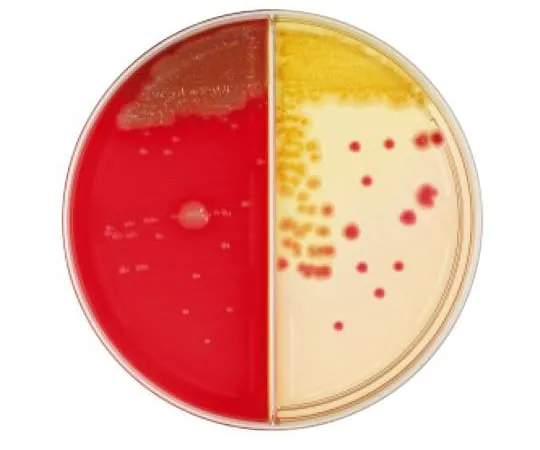 63-6527-87　BD BBL (TM) TSAII 5% sheep blood agar/DHL agar 100 sheets　252022