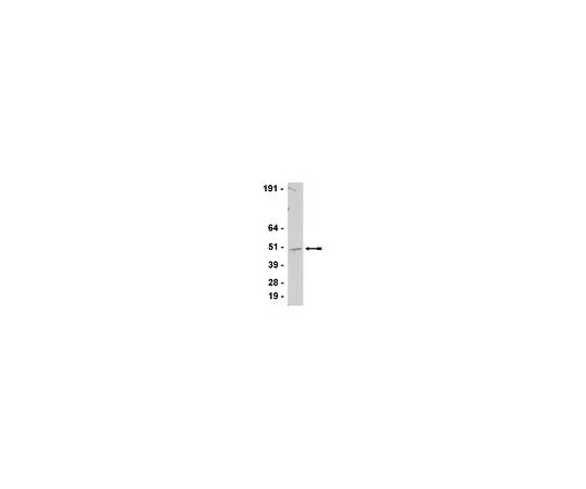 62-8385-66　［Discontinued］Anti-SUV39H1; 200 μg　07-550