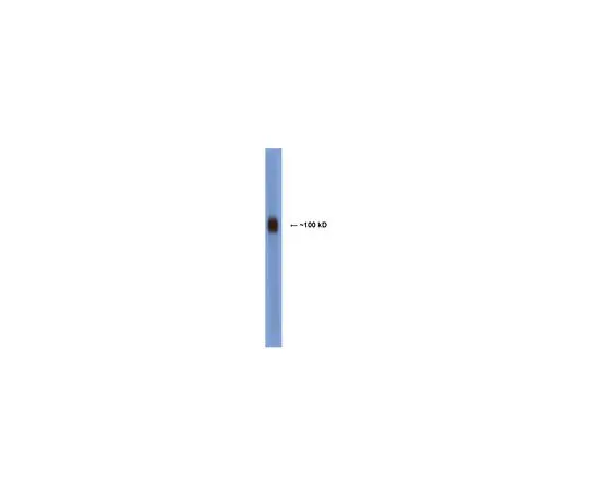 62-8498-06　［Discontinued］Anti-Vasoactive Intestinal Peptide Receptor 1; 100 μg　MAB5468