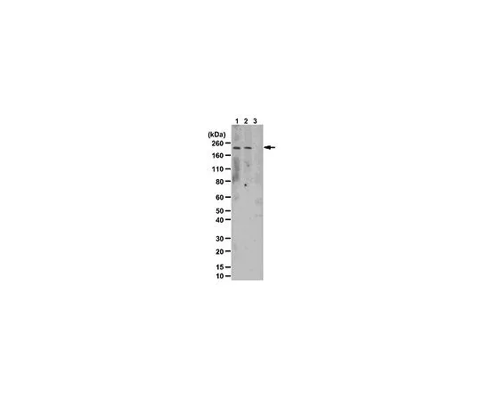 62-8469-40　［Discontinued］Anti-phospho-LRRK2 (Tyr1503); 100 μg　ABS107