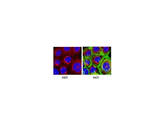 62-8497-21　［Discontinued］Anti-Presenilin-1, loop, a.a. 263-378, C-terminus, clone PS1-loop; 100 μL　MAB5232
