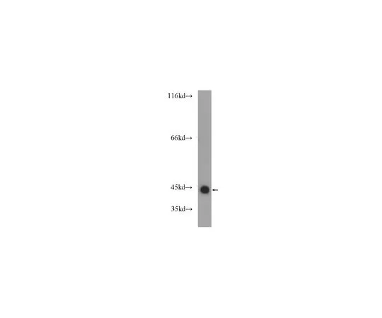 62-8462-58　［Discontinued］Anti-GTF2H2C　ABE633