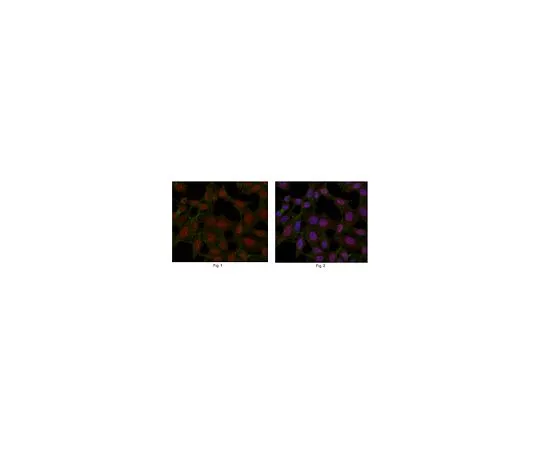 62-8501-86　［Discontinued］Anti-CDK6, clone　MABC280