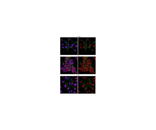 62-8383-30　［Discontinued］Anti-RNMT (mRNA methyltransferase); 100 μg　06-1355