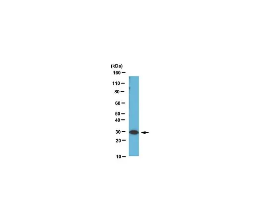 62-8461-39　［Discontinued］Anti-RPS3　ABE391