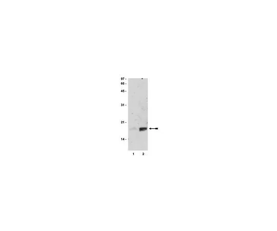 62-8382-30　［Discontinued］Anti-acetyl-Histone H3 (Lys14); 200 μg　06-911