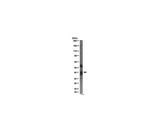 62-8382-75　［Discontinued］Anti-Protein Wnt-5a; 100 μg　06-1058