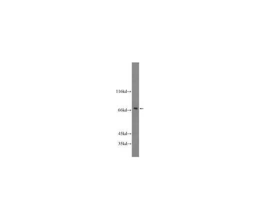 62-8467-69　［Discontinued］Anti-SOX5　ABN513