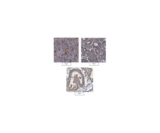 62-8458-22　［Discontinued］Anti-MACC1 Antibody　ABC447