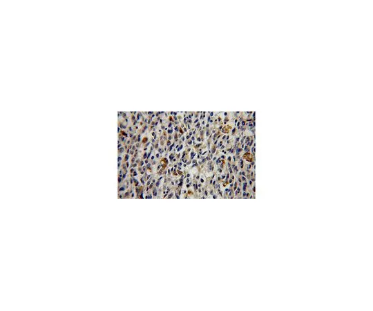 62-8470-85　［Discontinued］Anti-GALE　ABS591