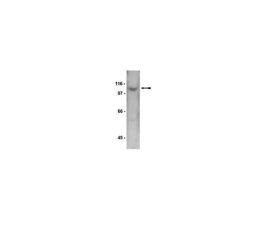 62-8381-47　［Discontinued］Anti-STAT2, CT; 200 μg　06-502